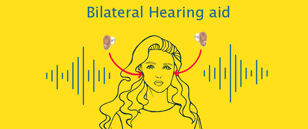 About Bilateral Fitting