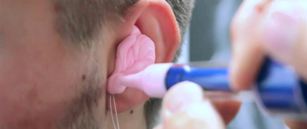 Ear impression procedures