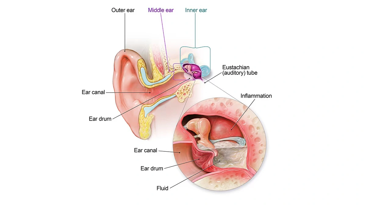 Hearing Aid Centre in Chennai